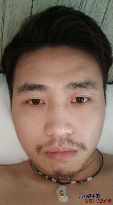 戒煙一年前后對比照